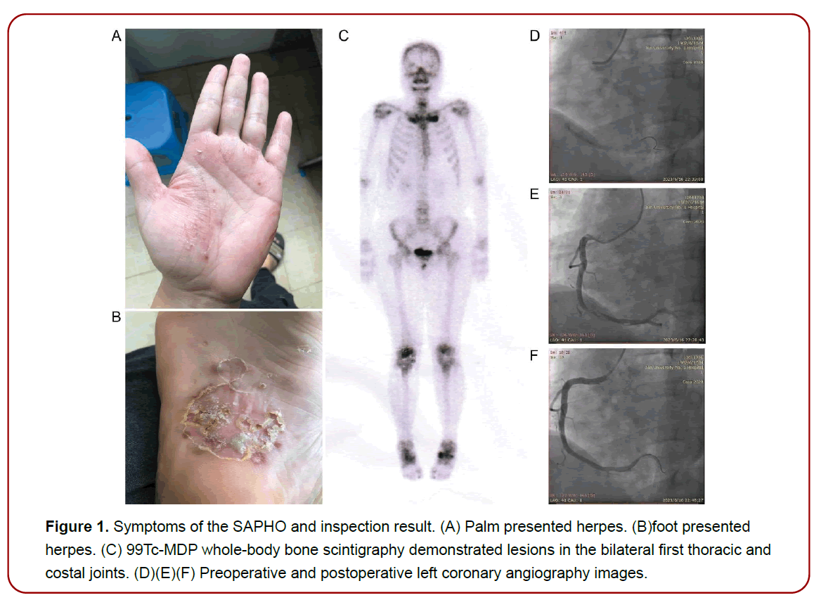 cardiovascular-diseases-therapeutics-coronary-angiography cardiovascular-diseases-therapeutics-coronary-angiography