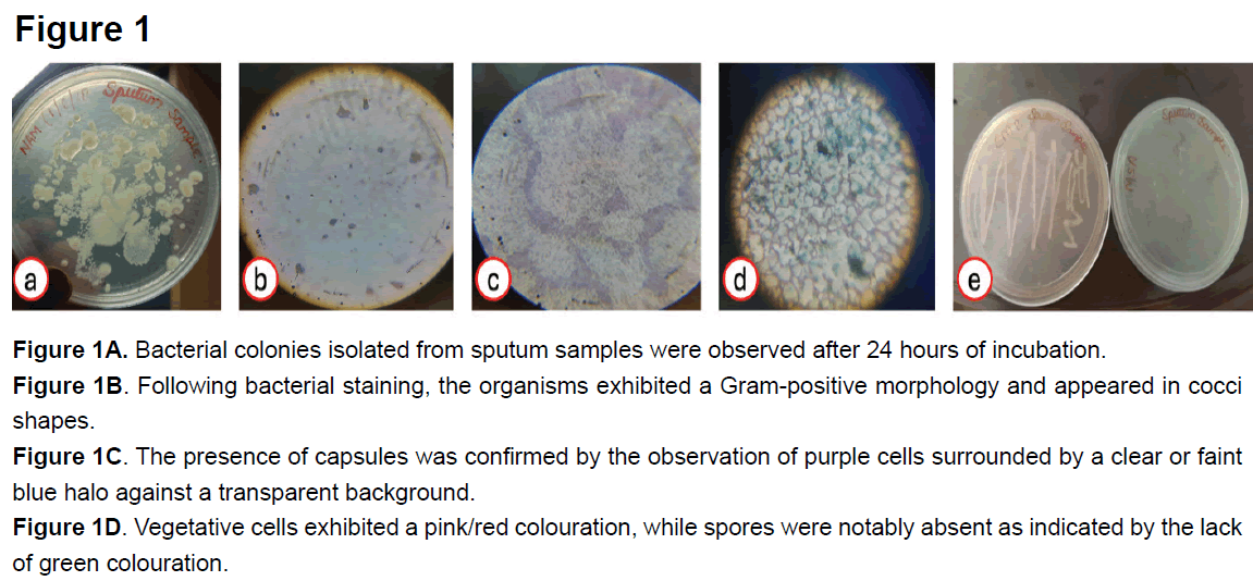 healthcare-advanced-nursing-sputum-samples