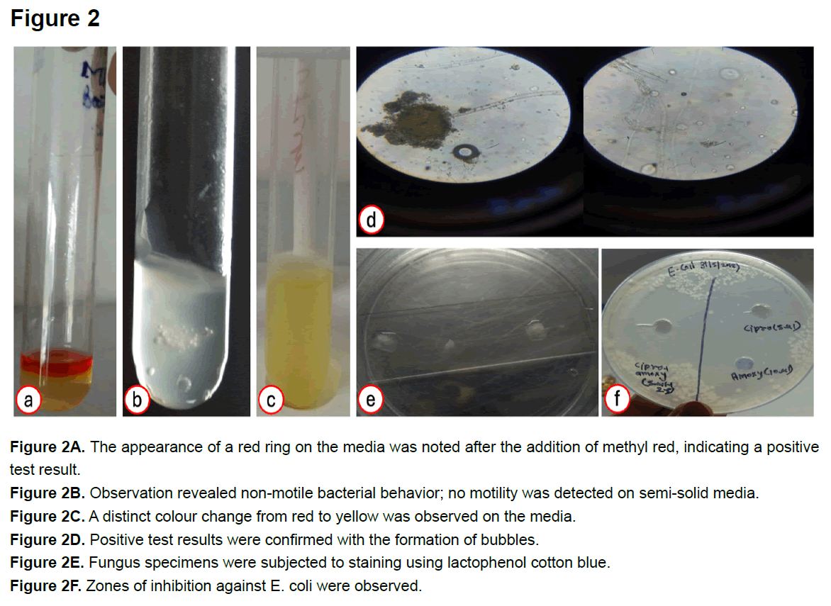 healthcare-advanced-nursing-sputum-samples