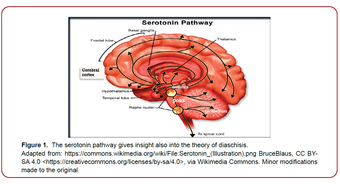 neuroimaging-neuromedicine-serotonin-pathway neuroimaging-neuromedicine-serotonin-pathway