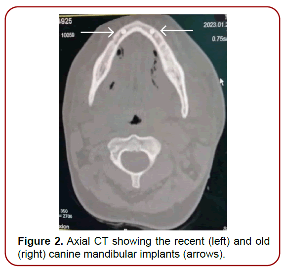 oral-diseases-treatment-edema-involving