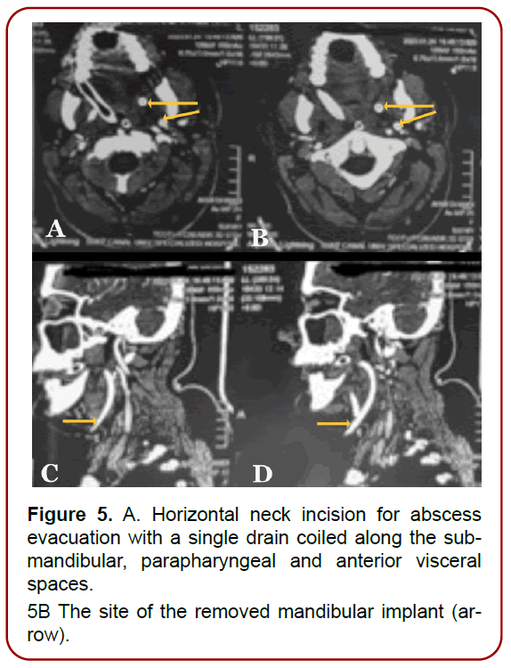 oral-diseases-treatment-edema-involving