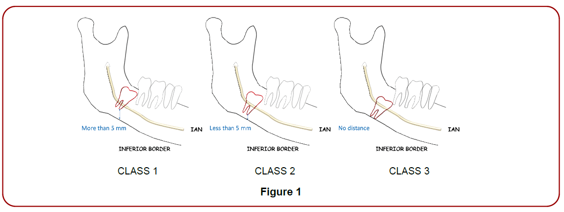 oral-diseases-treatment-mombru-classification