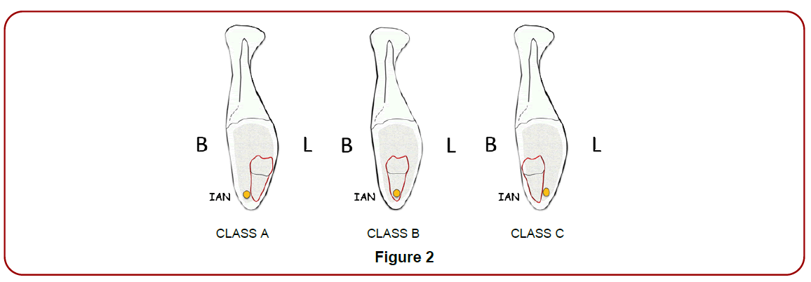 oral-diseases-treatment-mombru-classification