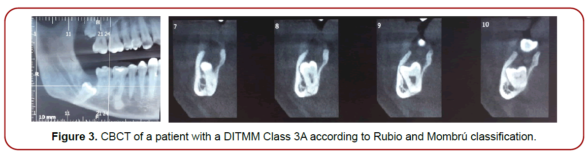 oral-diseases-treatment-mombru-classification