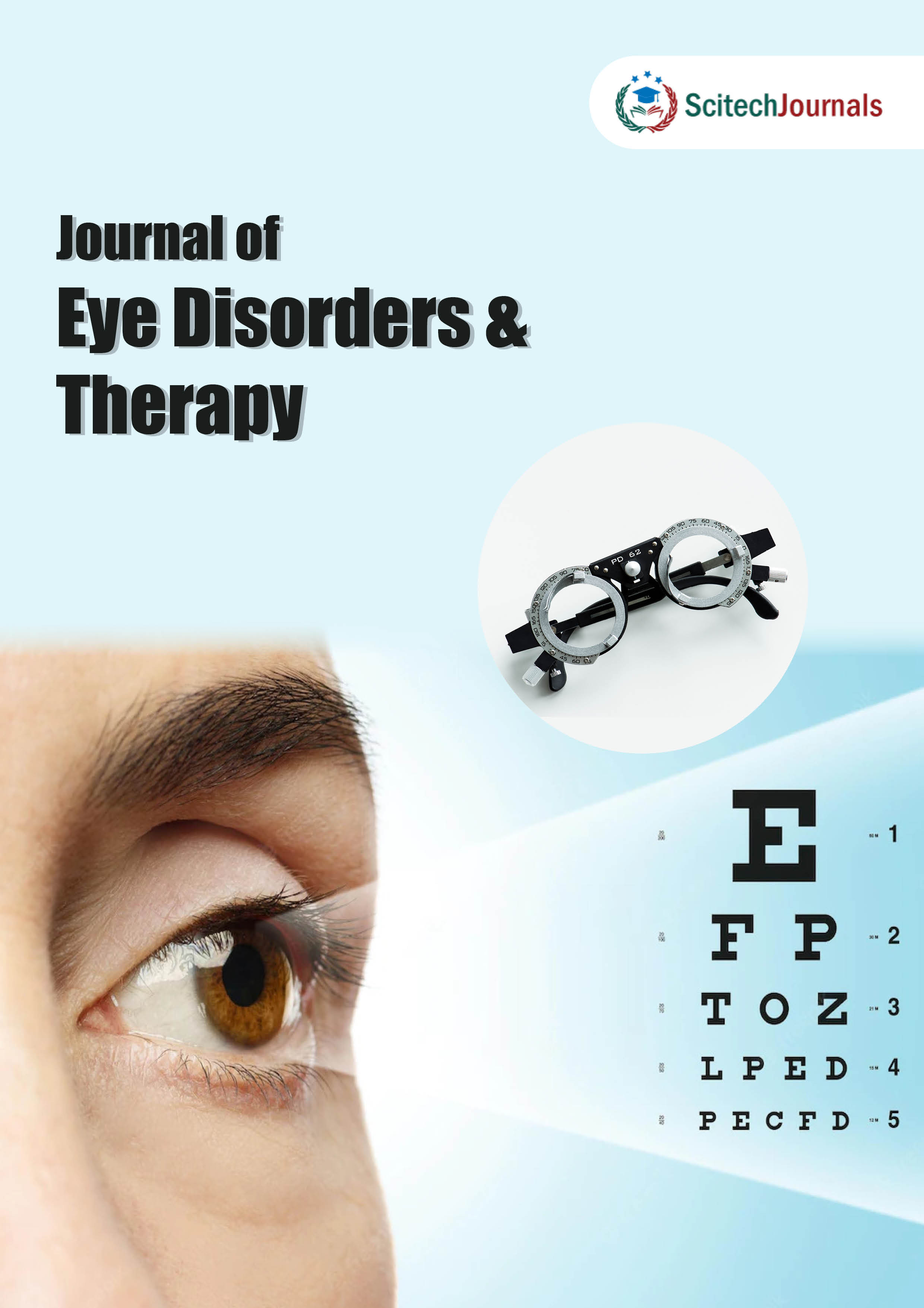Journal of Eye Disorders and Therapy